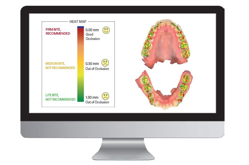 Image of Aoralscan 3