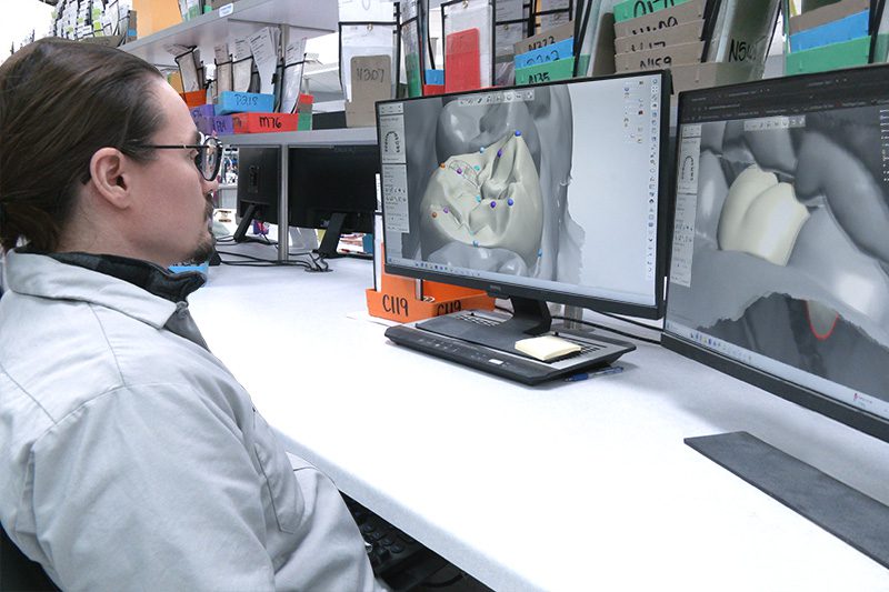 Image of Aoralscan 3